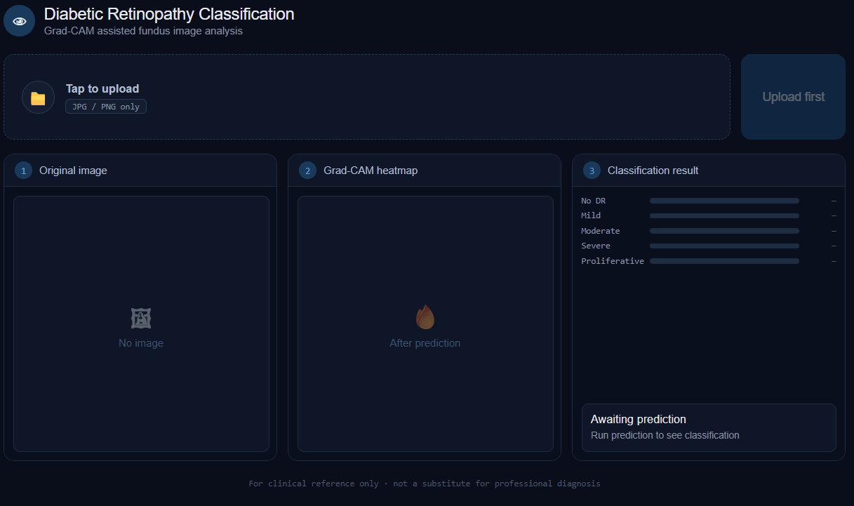 Thumbnail for DR Classification